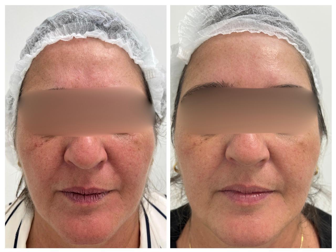 Rejuvenescimento